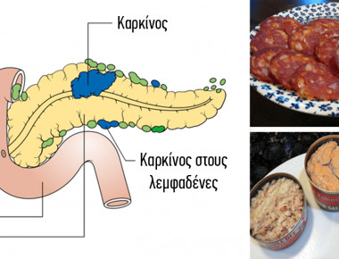 14 τροφές που έχουν αποδειχθεί ότι προκαλούν καρκίνο και δεν πρέπει να ξαναβάλετε στο στόμα σας